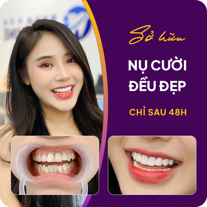Trước và sau khi mài răng của khách hàng
