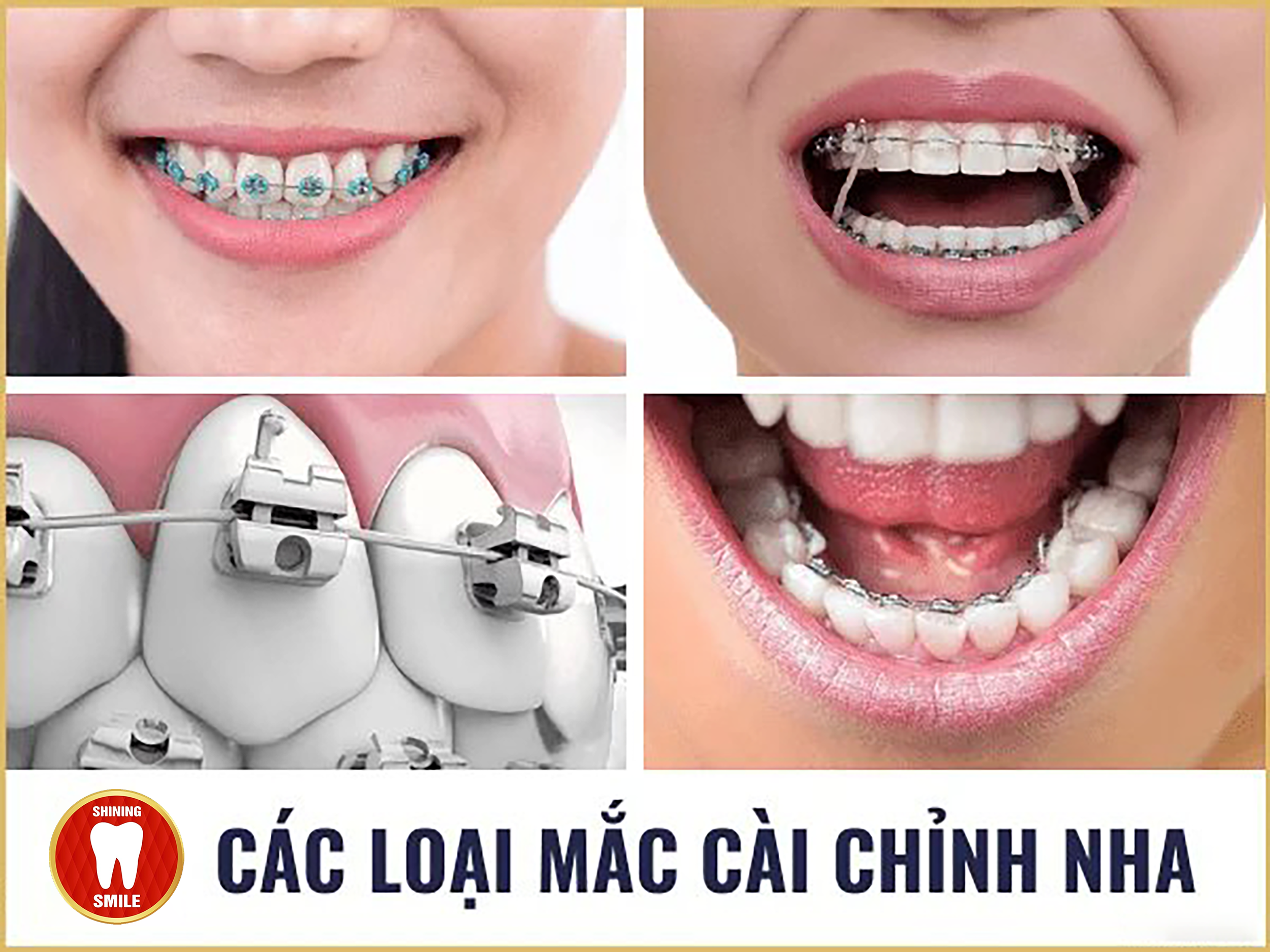 cac-loai-mac-cai.png