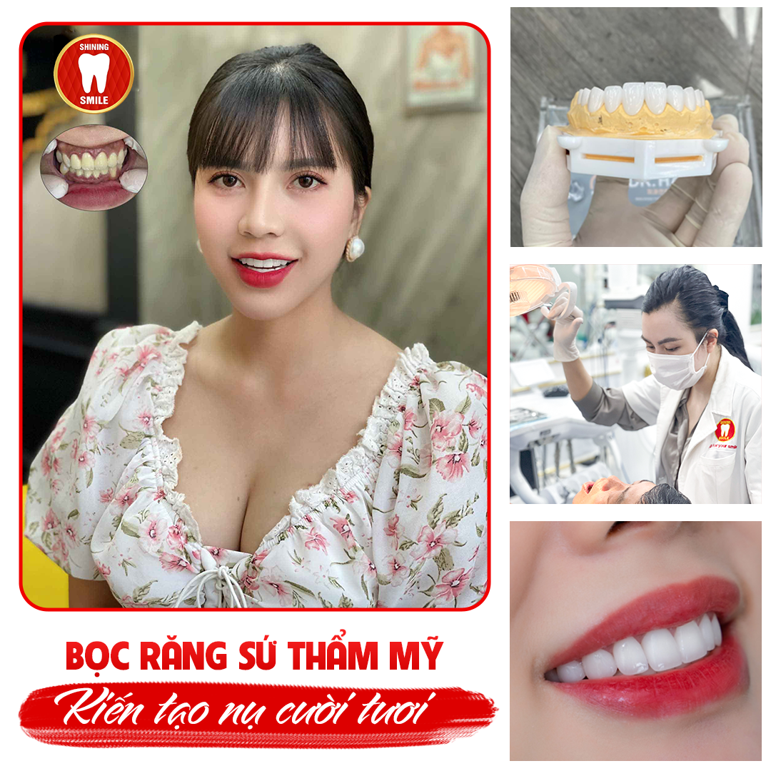 MÀI RĂNG BỌC SỨ CÓ ĐAU KHÔNG? CÓ ẢNH HƯỞNG GÌ KHÔNG?