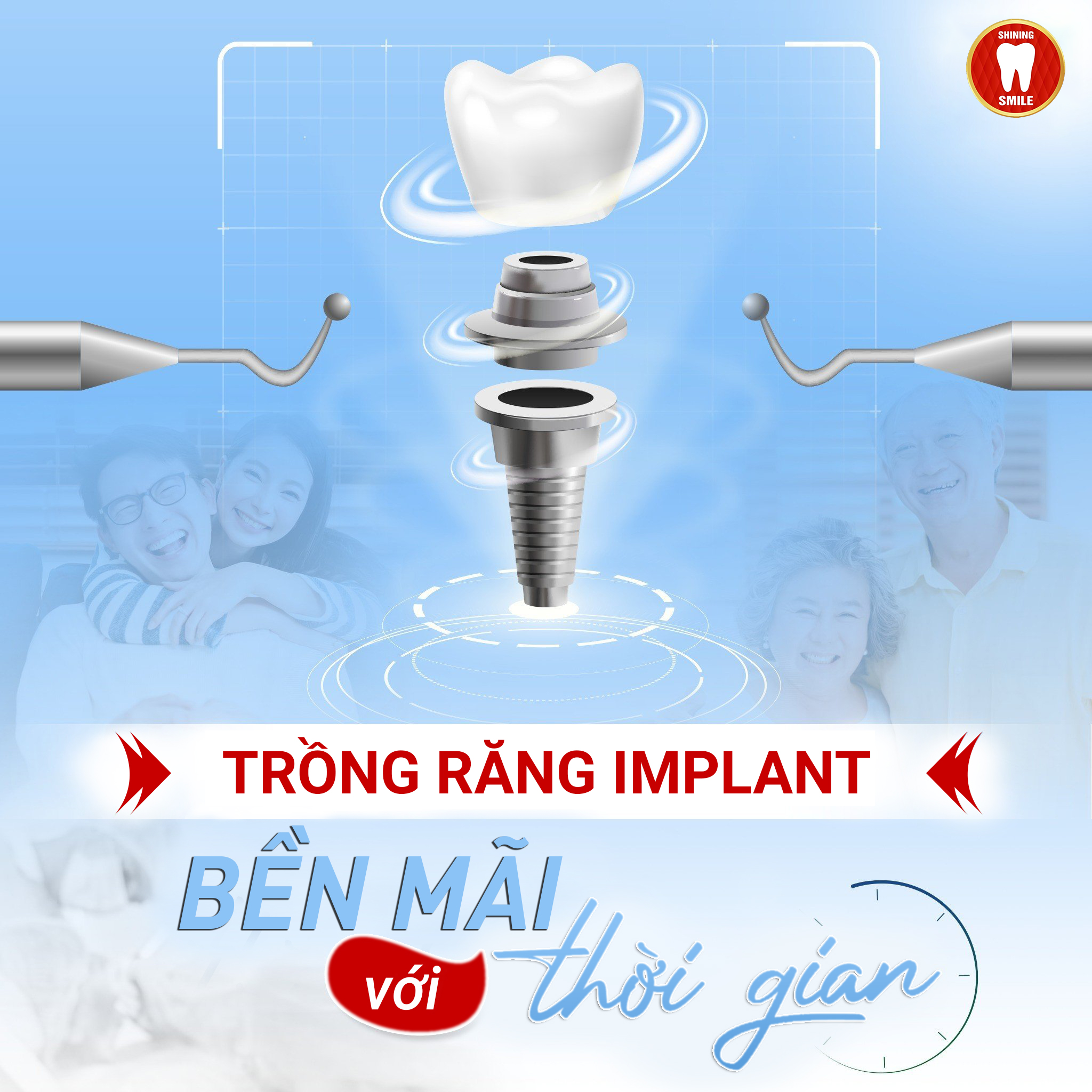 Mất răng lâu năm có trồng được không? Phương pháp nào tốt?