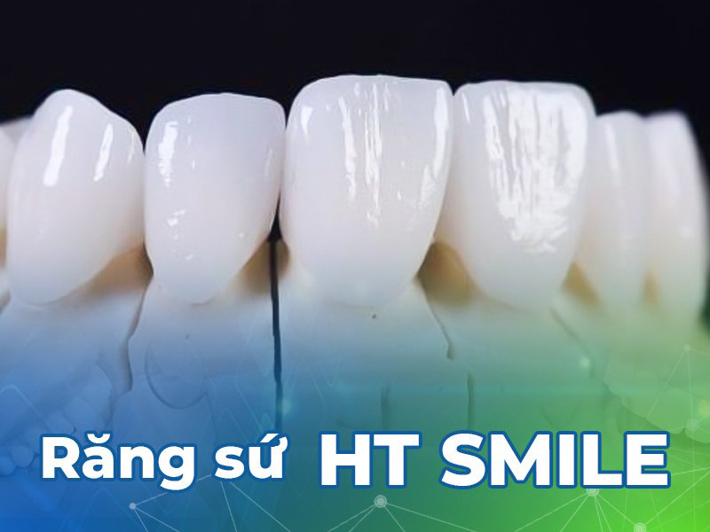 Răng Sứ HT Smile:  Lựa chọn hàng đầu cho răng thẩm mỹ