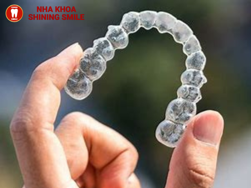 Niềng răng trong suốt giá bao nhiêu? Bảng giá chi tiết 2024