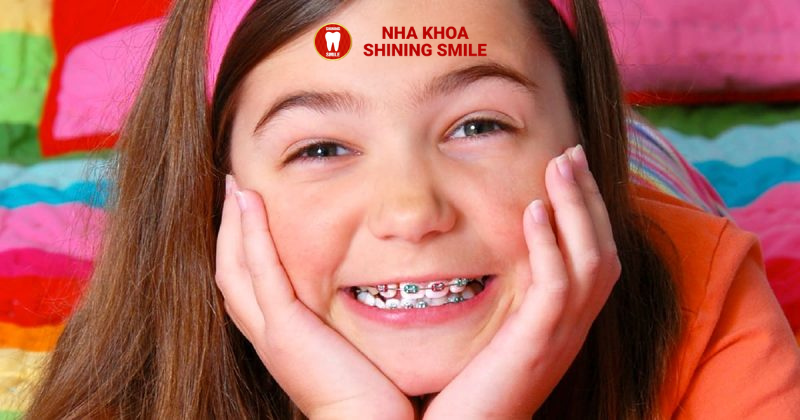 Niềng Răng Xong Bị Móm: Nguyên Nhân và Giải Pháp Từ Nha Khoa Shining Smile
