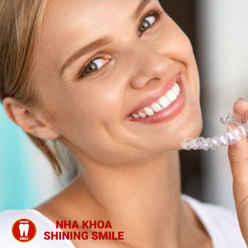 Răng Chạy Nhanh Khi Niềng: Hiệu Quả Và Tác Động