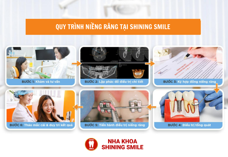 quy-trinh-nieng-rang-tai-shining-smile.png