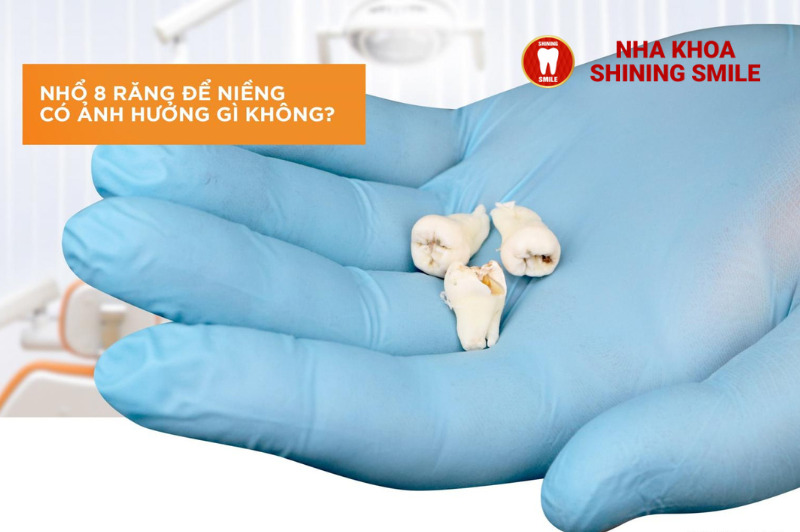 Nhổ 8 Răng Để Niềng: Khi Nào Cần Thiết Và Những Điều Cần Biết