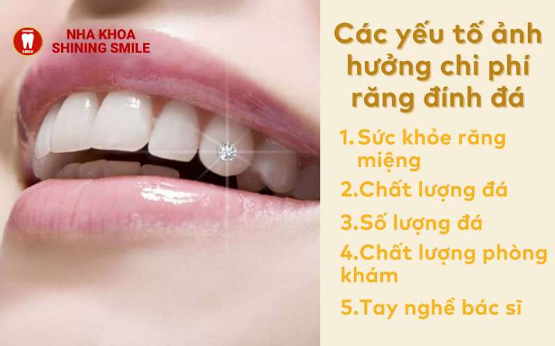 Răng đính đá bao nhiêu tiền là hợp lý? Bảng giá mới nhất hiện nay
