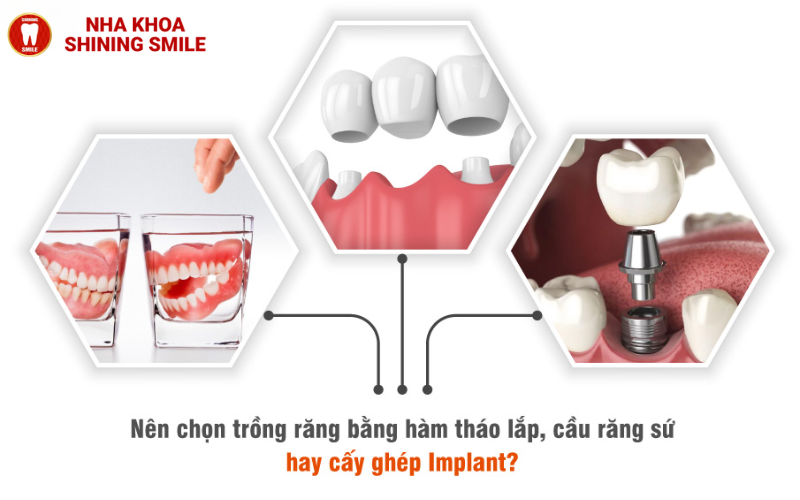 Răng Giả Cho Người Già Bao Nhiêu Tiền? Tiết Lộ Bảng Giá Sốc 2024