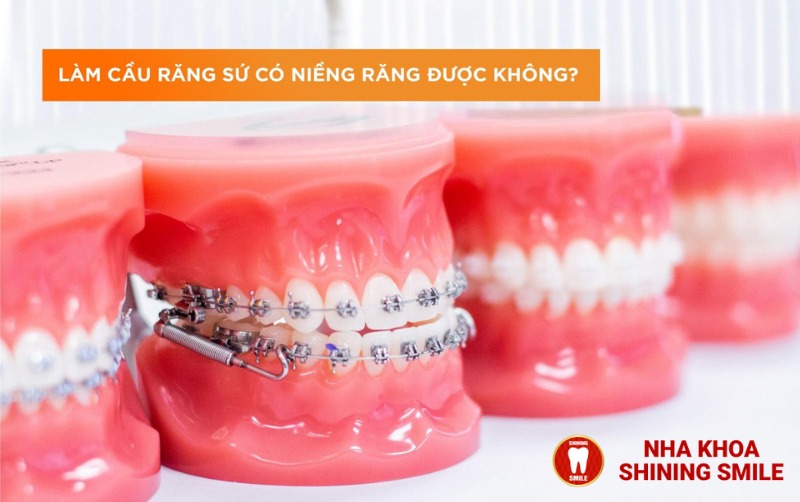 Làm Cầu Răng Sứ Có Niềng Răng Được Không?