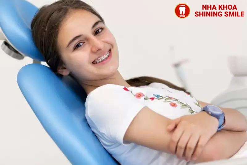 15 Tuổi Niềng Răng Bao Lâu? Tìm Hiểu Quy Trình Tại Nha Khoa Shining Smile