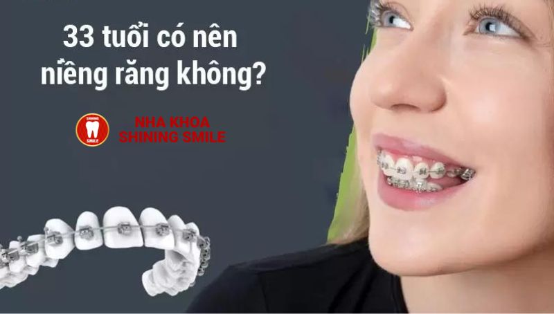 33 Tuổi Có Nên Niềng Răng Không? Khám Phá Lợi Ích Và Khuyến Nghị