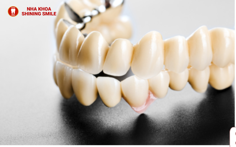 Răng Sứ Bao Nhiêu Một Cái? Khám Phá Chi Phí Và Lựa Chọn Tốt Nhất