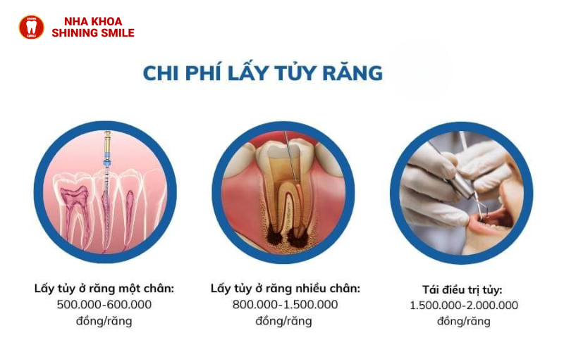 Diệt Tủy Răng Bao Nhiêu Tiền? Tiết Lộ Chi Phí Cập Nhật Mới Nhất