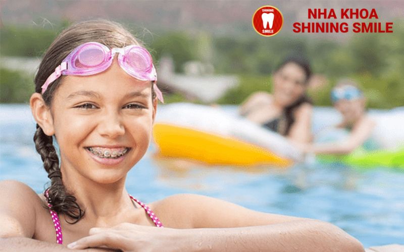 Niềng Răng Có Đi Bơi Được Không? Câu Trả Lời Sẽ Khiến Bạn Bất Ngờ!