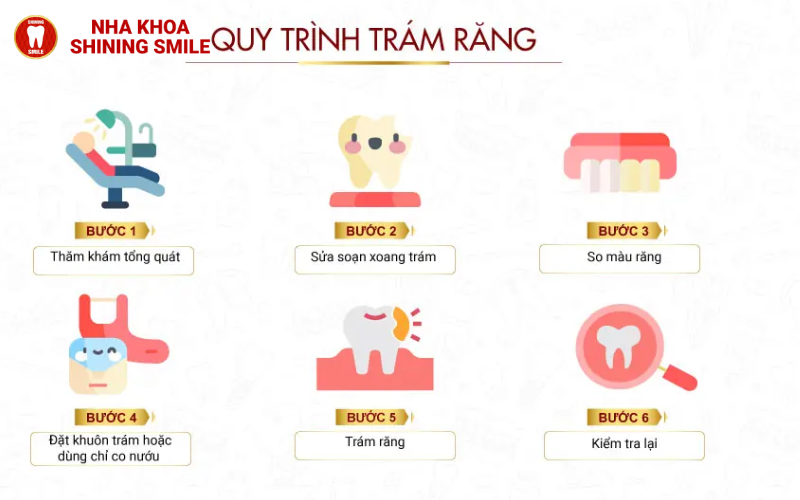 ch-hang-trai-nghiem-tot-nhat-hien-nay-ban-co-the-thuc-hien-nho-rang-va-cay-implant-cung-mot-luc-tuc-la-trong-rang-16.png