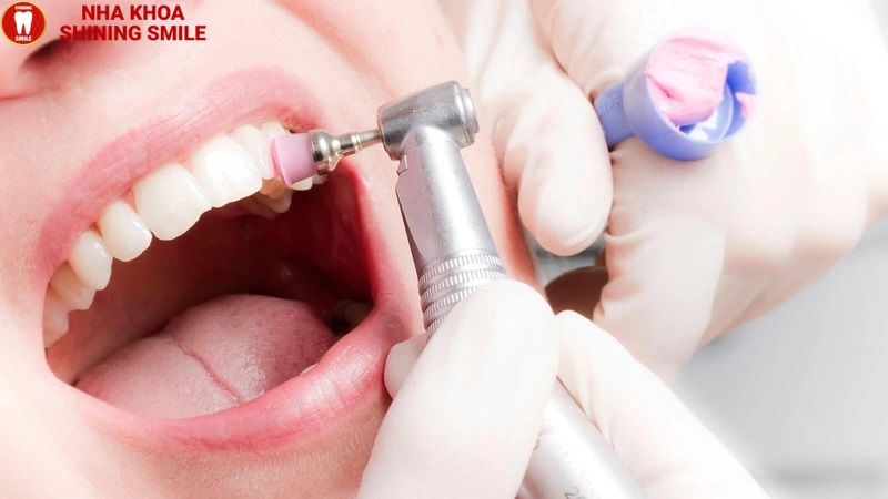 Bọc Răng Sứ Có Cắt Lợi Được Không? Quy Trình Thực Hiện