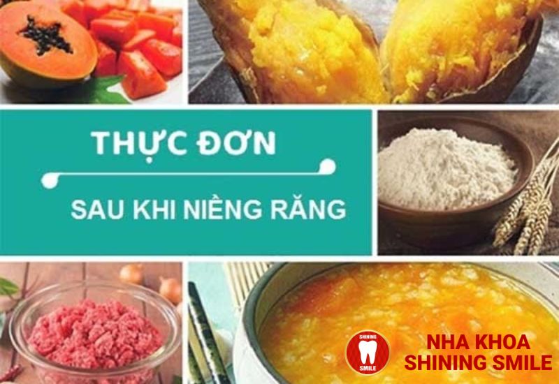 Thực Đơn Hoàn Hảo Cho Người Niềng Răng