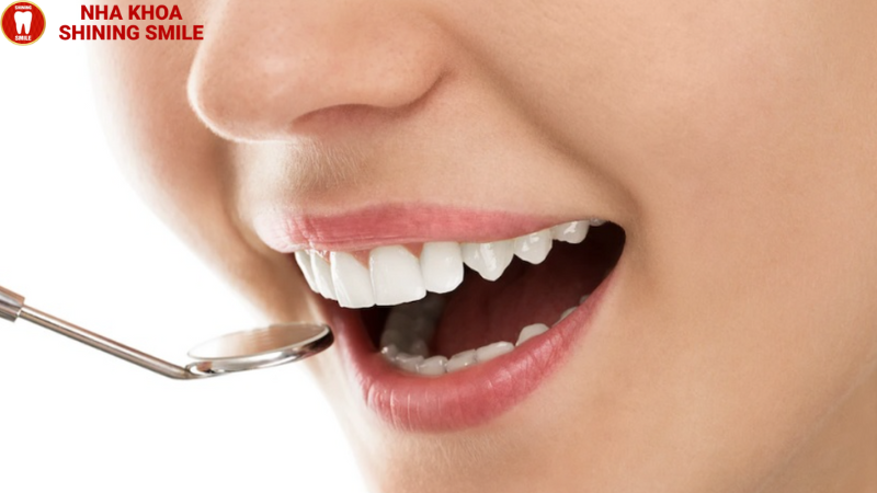 Răng Sứ Zirconia HT: Đặc Điểm Và Ưu Điểm