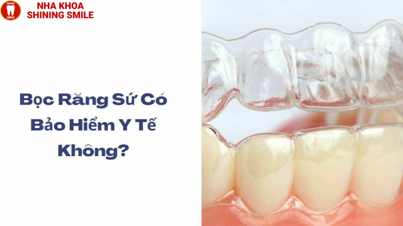 Bọc Răng Sứ Có Được Bảo Hiểm Không? Thông Tin Quan Trọng