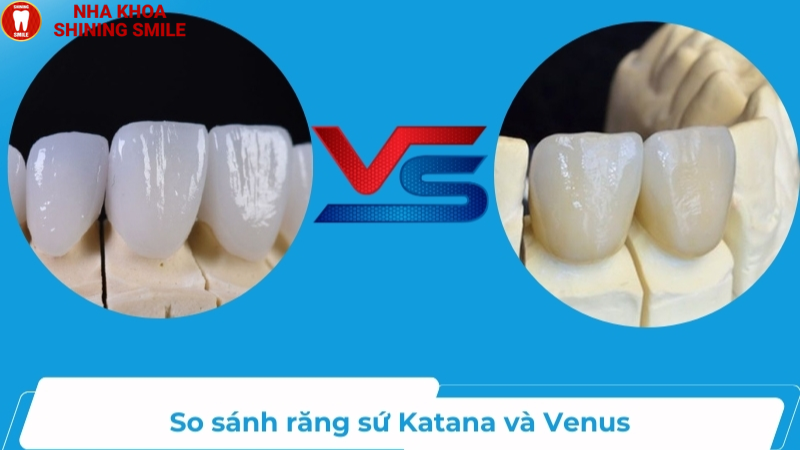 So Sánh Răng Sứ Katana Và Venus: Đặc Điểm Và Giá Cả