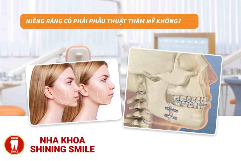 Sự Thật Về Niềng Răng: Niềng Răng Có Phải Phẫu Thuật Thẩm Mỹ Không?