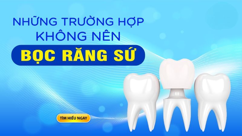 Những Trường Hợp Không Nên Bọc Răng Sứ: Lời Khuyên Từ Chuyên Gia