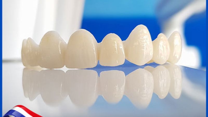 Răng Sứ DDBio: Công Nghệ Hiện Đại Cho Nụ Cười Hoàn Hảo