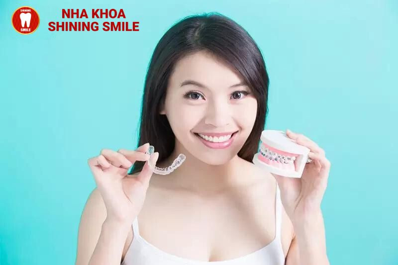 27 Tuổi Có Niềng Răng Được Không? Chuyên Gia Tư Vấn