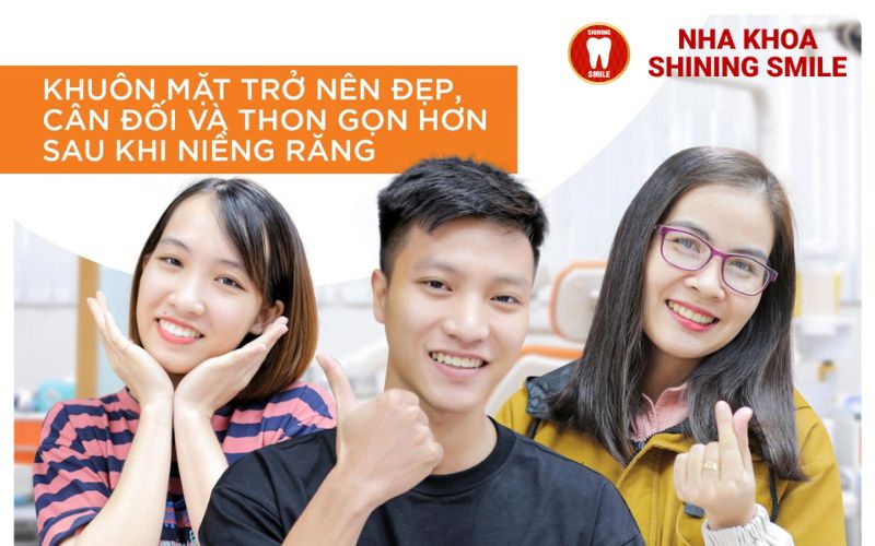 Niềng Răng Có Làm Thay Đổi Khuôn Mặt Không