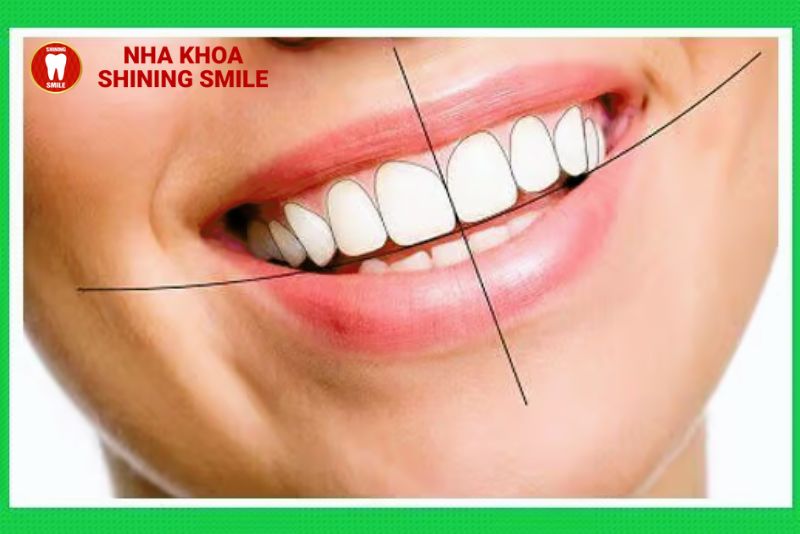 Hiểu Về Các Loại Khớp Cắn Trong Chỉnh Nha