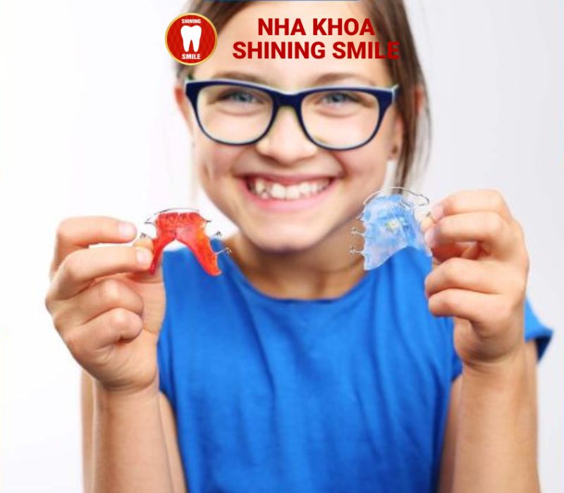 Hiệu Quả của Niềng Răng Thưa Cho Trẻ Em: Lợi Ích và Lý Do Nên Thực Hiện Sớm