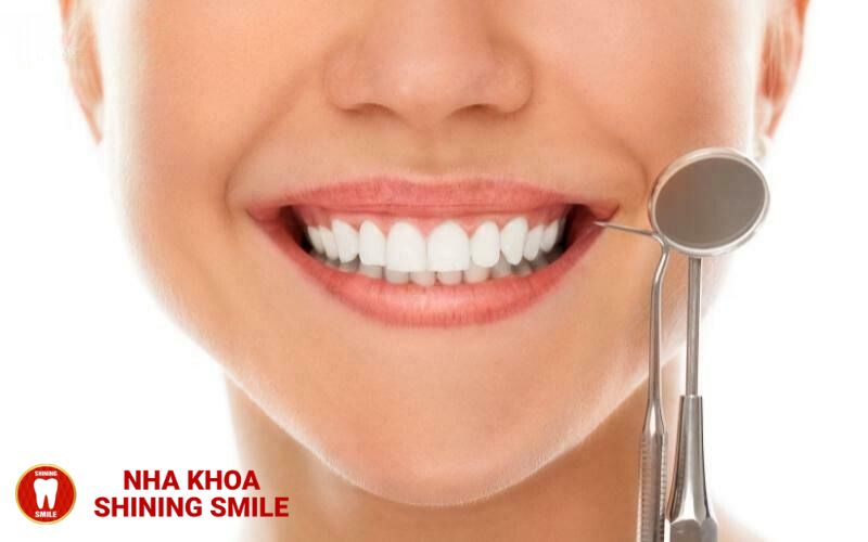 Tìm Hiểu Về Quá Trình Niềng Răng Lần 2: Những Điều Cần Lưu Ý