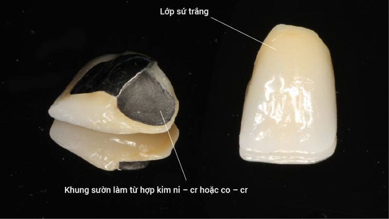 boc-rang-su-co-ben-khong-1.jpg