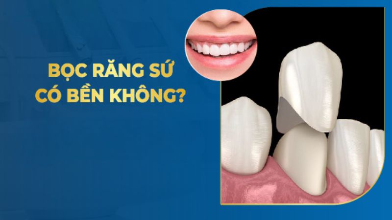 Bọc Răng Sứ Có Bền Không? Đánh Giá Từ Chuyên Gia