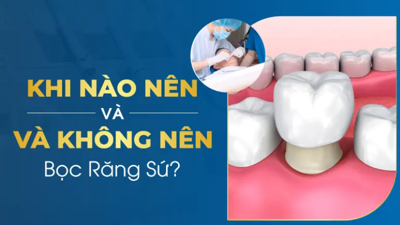 Răng Đã Trám Có Bọc Sứ Được Không? Thông Tin Chi Tiết