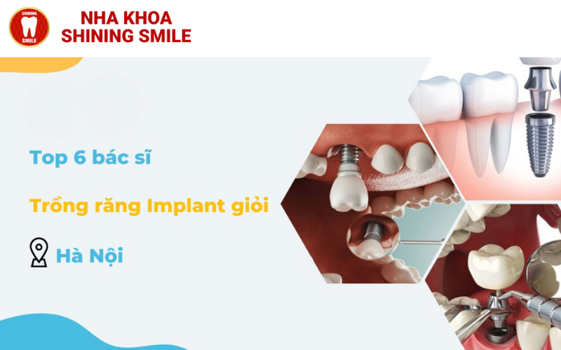 Bác Sĩ Cấy Implant Giỏi: Bí Quyết Chọn Đúng Người!