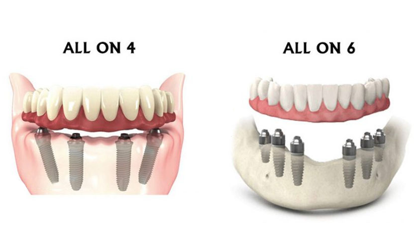 trong-rang-bat-vit-3.jpg