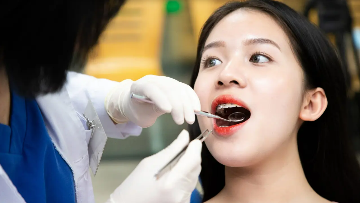 Niềng Răng ở Tuổi 17: Thời Gian Và Kết Quả Mong Đợi