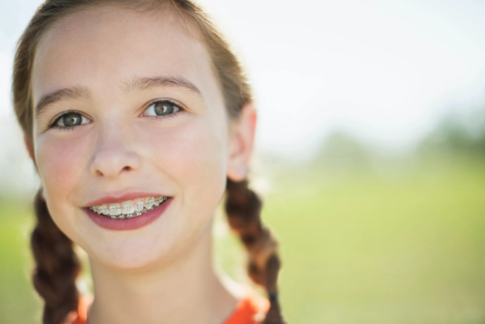 Niềng Răng Cho Trẻ 12 Tuổi: Lợi Ích Và Điều Cần Lưu Ý