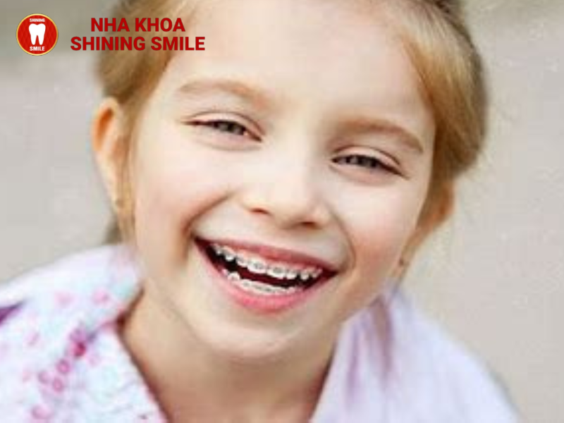 Độ tuổi vàng cho việc niềng răng