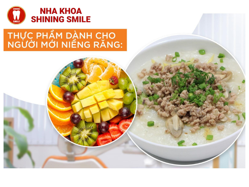 Niềng răng ăn gì? Chế độ ăn uống phù hợp cho người niềng răng