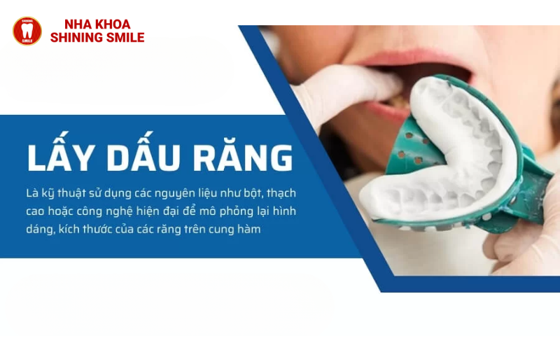 Lấy Dấu Răng Bao Nhiêu Tiền? Bảng Giá Chi Tiết!