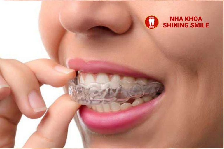 Bỏ Niềng Răng Giữa Chừng: Hậu Quả Và Lời Khuyên Từ Nha Sĩ