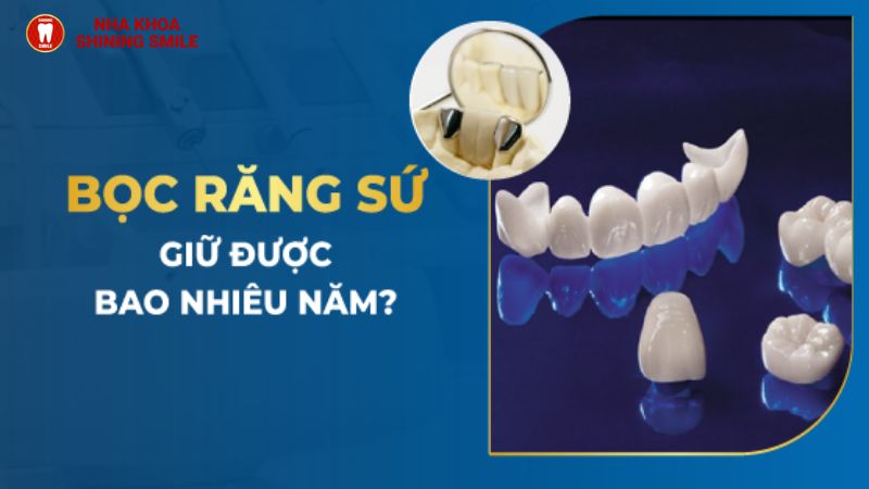 Bọc Răng Sứ Được Bao Lâu? Độ Bền Và Cách Bảo Quản