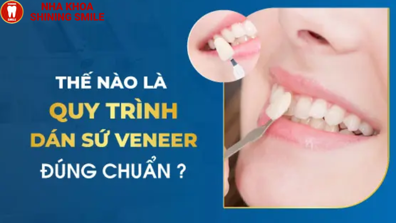 Quy Trình Dán Sứ Veneer: Từng Bước Một Chi Tiết