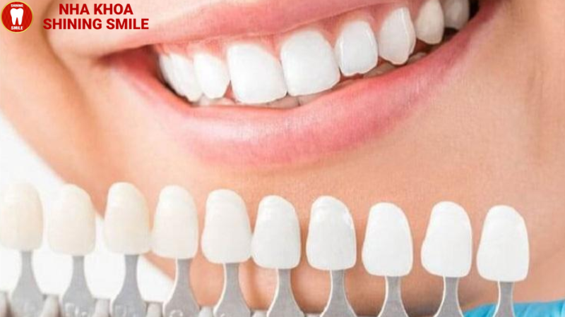 Răng Sứ Ceramic: Ưu Điểm Và Ứng Dụng