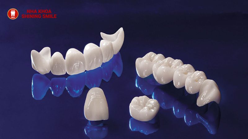 rang-su-ceramill-1.jpg