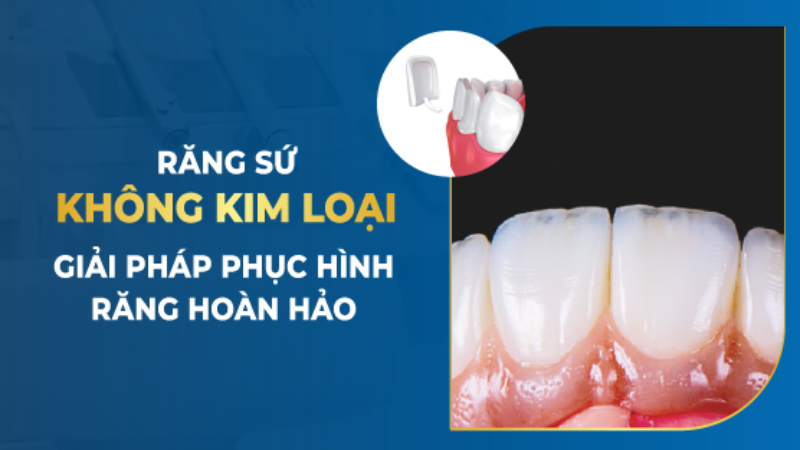Răng Sứ Không Kim Loại: Ưu Điểm Và Nhược Điểm