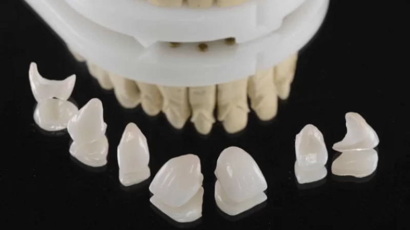 Răng Sứ Sage: Sự Lựa Chọn Hoàn Hảo Cho Nụ Cười Tươi Sáng