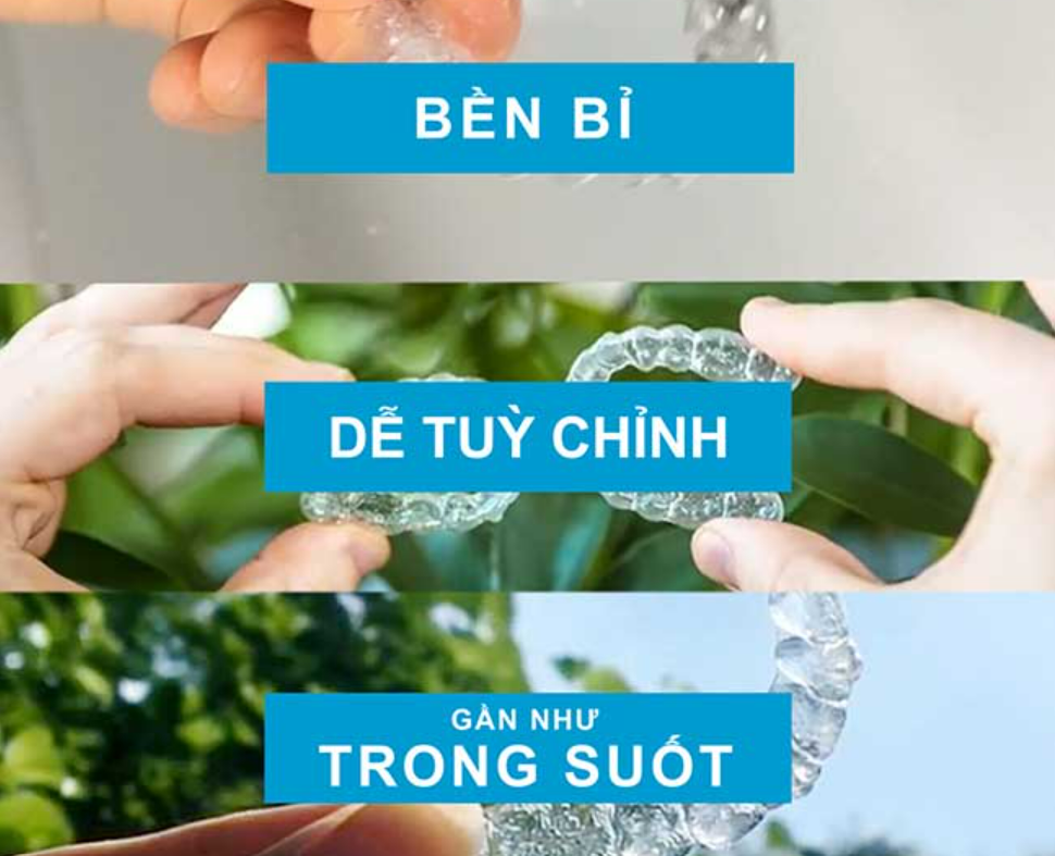 Chi Phí Niềng Răng Lệch Khớp Cắn Tại Shining Smile